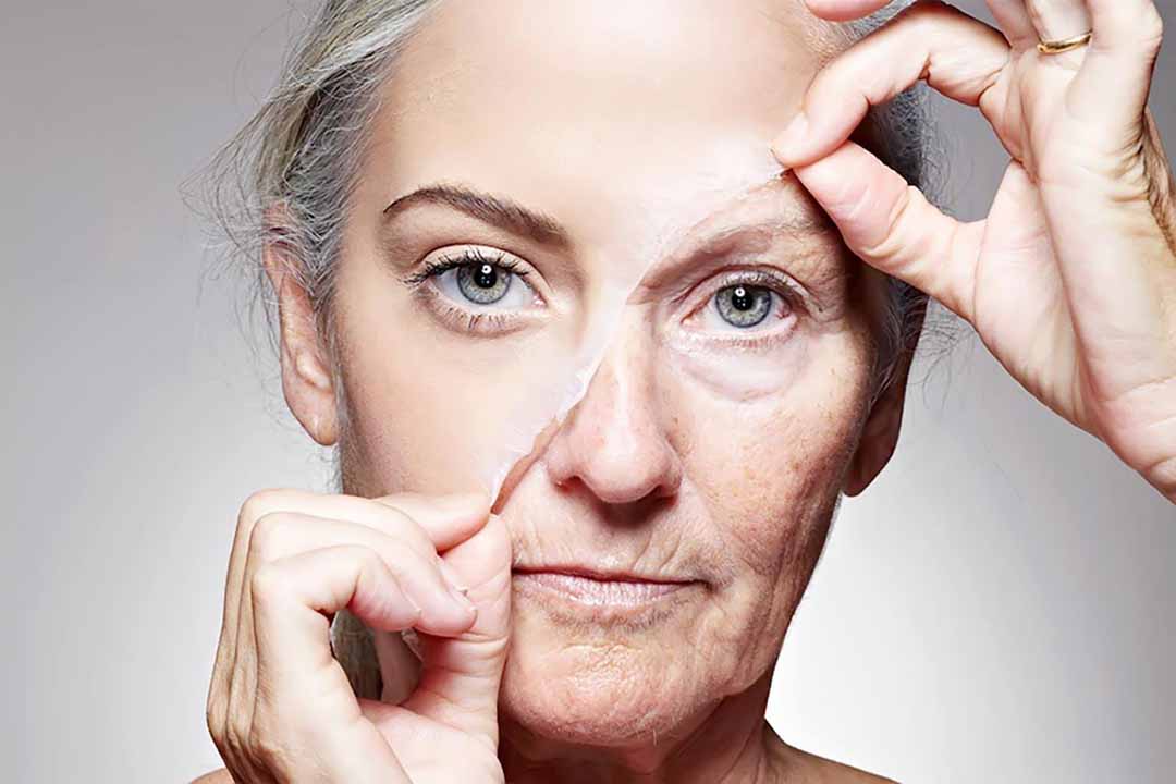 Những nếp nhăn khiến phụ nữ cảm thấy già nua, thiếu tự tin 